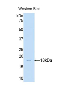 IL17RA Antibody - Western blot of recombinant IL17RA.  This image was taken for the unconjugated form of this product. Other forms have not been tested.