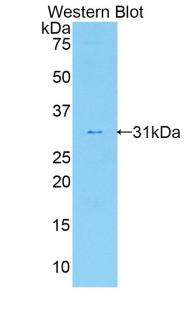 IL17RA Antibody - Western blot of recombinant IL17RA.  This image was taken for the unconjugated form of this product. Other forms have not been tested.