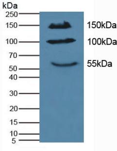 IL17RA Antibody - Western Blot; Sample: Mouse Pancreas Tissue.