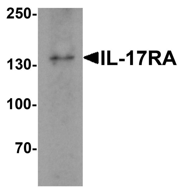 IL17RA Antibody - Western blot analysis of IL17RA in A20 cell lysate with IL17RA antibody at 1 ug/ml.