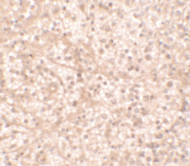 IL17RA Antibody - Immunohistochemistry of IL-17RA in human spleen tissue with IL-17RA antibody at 2.5 ug/ml.