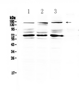 IL17RA Antibody - Western blot analysis of IL17RA using anti-IL17RA antibody. Electrophoresis was performed on a 5-20% SDS-PAGE gel at 70V (Stacking gel) / 90V (Resolving gel) for 2-3 hours. The sample well of each lane was loaded with 50ug of sample under reducing conditions. Lane 1: human Hela whole cell lysate,Lane 2: human HepG2 whole cell lysate,Lane 3: human MCF-7 whole cell lysate. After Electrophoresis, proteins were transferred to a Nitrocellulose membrane at 150mA for 50-90 minutes. Blocked the membrane with 5% Non-fat Milk/ TBS for 1.5 hour at RT. The membrane was incubated with rabbit anti-IL17RA antigen affinity purified polyclonal antibody at 0.5 µg/mL overnight at 4°C, then washed with TBS-0.1% Tween 3 times with 5 minutes each and probed with a goat anti-rabbit IgG-HRP secondary antibody at a dilution of 1:10000 for 1.5 hour at RT. The signal is developed using an Enhanced Chemiluminescent detection (ECL) kit with Tanon 5200 system. A specific band was detected for IL17RA at approximately 160KD. The expected band size for IL17RA is at 96KD.