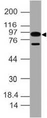 IL17RA Antibody - Fig-1: Western blot analysis of IL-17 RA. Anti- IL-17 RA antibody was used at 4 µg/ml on h Intestine lysate.