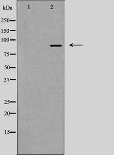 IL17RA Antibody - Western blot analysis of extracts of LOVO cells using IL17RA antibody. The lane on the left is treated with the antigen-specific peptide.