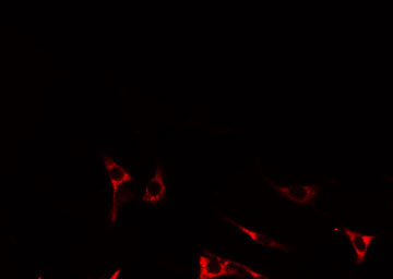 IL17RA Antibody - Staining LOVO cells by IF/ICC. The samples were fixed with PFA and permeabilized in 0.1% Triton X-100, then blocked in 10% serum for 45 min at 25°C. The primary antibody was diluted at 1:200 and incubated with the sample for 1 hour at 37°C. An Alexa Fluor 594 conjugated goat anti-rabbit IgG (H+L) Ab, diluted at 1/600, was used as the secondary antibody.