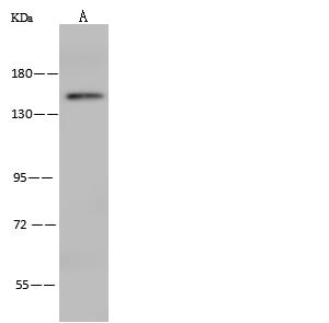 IL17RA Antibody - Anti-IL17RA rabbit polyclonal antibody at 1:500 dilution. Lane A: HeLa Whole Cell Lysate. Lysates/proteins at 30 ug per lane. Secondary: Goat Anti-Rabbit IgG (H+L)/HRP at 1/10000 dilution. Developed using the ECL technique. Performed under reducing conditions. Predicted band size: 96 kDa.