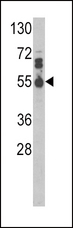 IL17RB Antibody - Western blot of IL17RB Antibody in MDA-MB468 cell line lysates (35 ug/lane). IL17RB (arrow) was detected using the purified antibody.