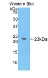 IL17RB Antibody - Western blot of recombinant IL17RB.  This image was taken for the unconjugated form of this product. Other forms have not been tested.