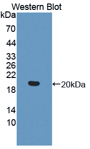 IL17RB Antibody - Western blot of IL17RB antibody.