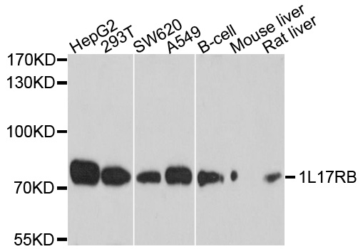 IL17RB Antibody - Western blot analysis of extracts of various cell lines, using IL17RB antibody at 1:1000 dilution. The secondary antibody used was an HRP Goat Anti-Rabbit IgG (H+L) at 1:10000 dilution. Lysates were loaded 25ug per lane and 3% nonfat dry milk in TBST was used for blocking. An ECL Kit was used for detection and the exposure time was 5s.
