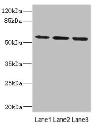 IL17RB Antibody - Western blot All Lanes: IL17RBantibody at 2.16ug/ml Lane 1: 293T whole cell lysate Lane 2: Hela whole cell lysate Lane 3: HepG-2 whole cell lysate Secondary Goat polyclonal to rabbit IgG at 1/10000 dilution Predicted band size: 56,32 kDa Observed band size: 56 kDa