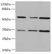 IL17RB Antibody - Western blot All lanes: IL17RB antibody at 2.16µg/ml Lane 1: 293T whole cell lysate Lane 2: Hela whole cell lysate Lane 3: HepG2 whole cell lysate Secondary Goat polyclonal to rabbit IgG at 1/10000 dilution Predicted band size: 56, 32 kDa Observed band size: 56, 32 kDa