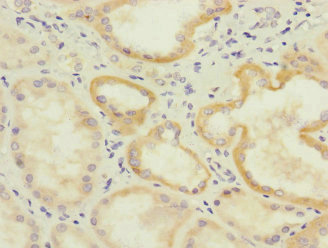IL17RB Antibody - Immunohistochemistry of paraffin-embedded human kidney tissue at dilution 1:100