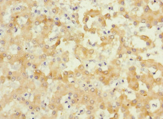 IL17RB Antibody - Immunohistochemistry of paraffin-embedded human liver tissue at dilution 1:100