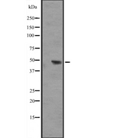 IL17RB Antibody - Western blot analysis of IL17RB expression in HEK293 cells. The lane on the left is treated with the antigen-specific peptide.