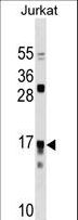 IL17RC Antibody - IL17RC Antibody western blot of Jurkat cell line lysates (35 ug/lane). The IL17RC antibody detected the IL17RC protein (arrow).