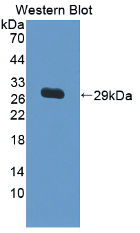 IL17RC Antibody - Western blot of IL17RC antibody.