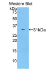 IL17RC Antibody - Western blot of recombinant IL17RC.  This image was taken for the unconjugated form of this product. Other forms have not been tested.