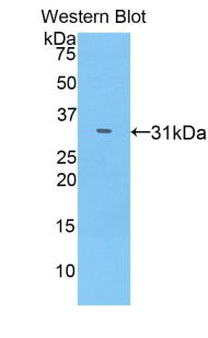 IL17RC Antibody - Western blot of recombinant IL17RC.  This image was taken for the unconjugated form of this product. Other forms have not been tested.