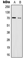 IL17RC Antibody - Western blot analysis of IL-17RC expression in HeLa (A); U251MG (B) whole cell lysates.