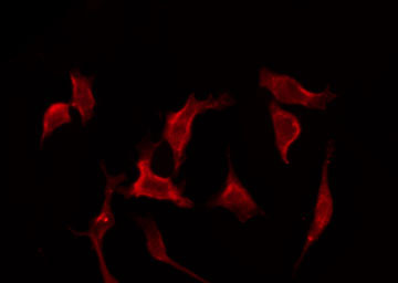 IL17RC Antibody - Staining HeLa cells by IF/ICC. The samples were fixed with PFA and permeabilized in 0.1% Triton X-100, then blocked in 10% serum for 45 min at 25°C. The primary antibody was diluted at 1:200 and incubated with the sample for 1 hour at 37°C. An Alexa Fluor 594 conjugated goat anti-rabbit IgG (H+L) Ab, diluted at 1/600, was used as the secondary antibody.