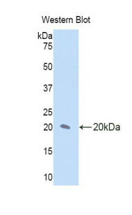 IL17RD Antibody - Western blot of recombinant IL17RD / SEF.  This image was taken for the unconjugated form of this product. Other forms have not been tested.