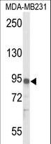 IL17RD Antibody - Western blot of IL17RD Antibody in MDA-MB231 cell line lysates (35 ug/lane). IL17RD (arrow) was detected using the purified antibody.