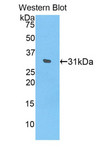 IL17RD Antibody - Western blot of recombinant IL17RD / SEF.  This image was taken for the unconjugated form of this product. Other forms have not been tested.