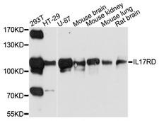 IL17RD Antibody - Western blot analysis of extracts of various cell lines, using IL17RD antibody at 1:1000 dilution. The secondary antibody used was an HRP Goat Anti-Rabbit IgG (H+L) at 1:10000 dilution. Lysates were loaded 25ug per lane and 3% nonfat dry milk in TBST was used for blocking. An ECL Kit was used for detection and the exposure time was 30s.