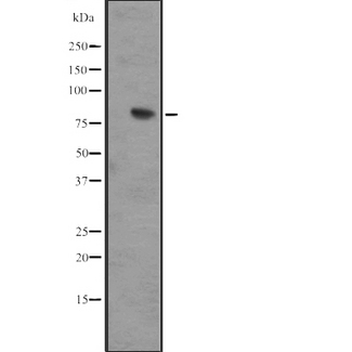 IL17RD Antibody - Western blot analysis of IL17RD expression in IMR32 whole cells lysate. The lane on the left is treated with the antigen-specific peptide.