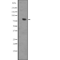 IL17RD Antibody - Western blot analysis of IL17RD expression in IMR32 whole cells lysate. The lane on the left is treated with the antigen-specific peptide.