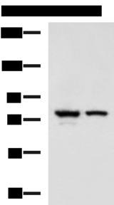 IL17RD Antibody - Western blot analysis of A172 and 231 cell lysates  using IL17RD Polyclonal Antibody at dilution of 1:900