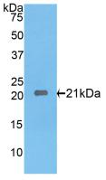 IL17RE Antibody - Western Blot; Sample: Recombinant IL17RE, Rat.