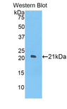 IL17RE Antibody - Western blot of recombinant IL17RE.  This image was taken for the unconjugated form of this product. Other forms have not been tested.