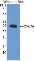 IL17RE Antibody - Western Blot; Sample: Recombinant IL17RE, Mouse.