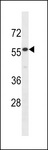 IL17RE Antibody - IL17RE Antibody western blot of HepG2 cell line lysates (35 ug/lane). The IL17RE antibody detected the IL17RE protein (arrow).