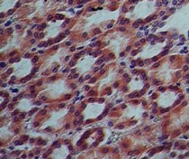 IL17RE Antibody - Immunohistochemistry-Paraffin: IL17RE Antibody (46N7E3) - analysis of IL-17RE in formalin-fixed, paraffin-embedded human kidney tissue using IL-17RE antibody at 10 ug/ml.
