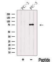 IL17RE Antibody - Western blot analysis of extracts of PC-3 cells using IL17RE antibody. The lane on the left was treated with blocking peptide.