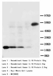IL18 Antibody -  This image was taken for the unconjugated form of this product. Other forms have not been tested.