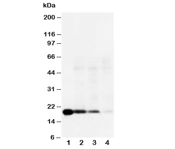 IL18 Antibody - Western blot testing of IL-18 antibody and Lane 1: Recombinant human IL-18 protein 10ng; 2: 5ng; 3: 2.5ng; 4: Raji; Predicted molecular weight: 17~24 kDa