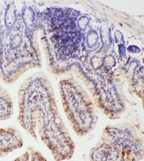IL18 Antibody - IHC analysis of IL-18 using anti-IL-18 antibody. IL-18 was detected in paraffin-embedded section of mouse intestine tissues. Heat mediated antigen retrieval was performed in citrate buffer (pH6, epitope retrieval solution) for 20 mins. The tissue section was blocked with 10% goat serum. The tissue section was then incubated with 1µg/ml rabbit anti-IL-18 Antibody overnight at 4°C. Biotinylated goat anti-rabbit IgG was used as secondary antibody and incubated for 30 minutes at 37°C. The tissue section was developed using Strepavidin-Biotin-Complex (SABC) with DAB as the chromogen.