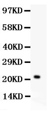 IL18 Antibody - IL18 antibody Western blot. All lanes: Anti IL18 at 0.5 ug/ml. WB: Recombinant Mouse IL18 Protein 0.5ng. Predicted band size: 22 kD. Observed band size: 22 kD.