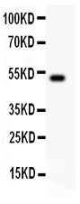 IL18 Antibody - IL18 antibody Western blot. All lanes: Anti IL18 at 0.5 ug/ml. WB: NIH3T3 Whole Cell Lysate at 40 ug. Predicted band size: 22 kD. Observed band size: 50 kD.