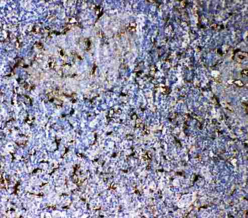 IL18 Antibody - Anti-IL-18 antibody, IHC(P): Human Tonsil Tissue