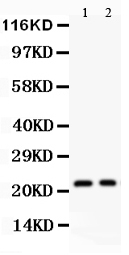 IL18 Antibody - Anti-IL-18 antibody, Western blotting All lanes: Anti IL-18 at 0.5ug/ml Lane 1: HELA Whole Cell Lysate at 40ugLane 2: Human Placenta Tissue Lysate at 50ugPredicted bind size: 22KD Observed bind size: 22KD