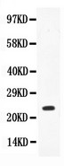 IL18 Antibody - WB of IL18 antibody. All lanes: Anti-IL18 at 0.5ug/ml. WB: Recombinant Human IL18 Protein 0.5ng. Predicted bind size: 24KD. Observed bind size: 24KD.