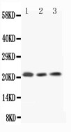 IL18 Antibody - WB of IL18 antibody. All lanes: Anti-IL18 at 0.5ug/ml. Lane 1: Rat Spleen Tissue Lysate at 40ug. Lane 2: Rat Thymus Tissue Lysate at 40ug. Lane 3: PC12 Whole Cell Lysate at 40ug. Predicted bind size: 22KD. Observed bind size: 22KD.