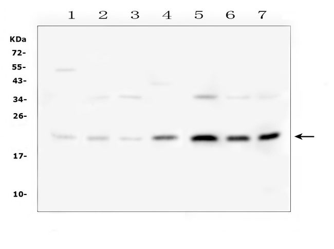IL18 Antibody - Western blot analysis of IL18 using anti-IL18 antibody. Electrophoresis was performed on a 5-20% SDS-PAGE gel at 70V (Stacking gel) / 90V (Resolving gel) for 2-3 hours. The sample well of each lane was loaded with 50ug of sample under reducing conditions. Lane 1: rat brain tissue lysates, Lane 2: rat lung tissue lysates, Lane 3: rat spleen tissue lysates. Lane 4: rat liver tissue lysates. Lane 5: rat testis tissue lysates. Lane 6: rat RH35 lysates. Lane 7: rat PC-12 whole cell lysates. After Electrophoresis, proteins were transferred to a Nitrocellulose membrane at 150mA for 50 minutes. Blocked the membrane with 5% Non-fat Milk/ TBS for 1.5 hour at RT. The membrane was incubated with rabbit anti-IL18 antigen affinity purified polyclonal antibody at 0.5 µg/mL overnight at 4°C, then washed with TBS-0.1% Tween 3 times with 5 minutes each and probed with a goat anti-rabbit IgG-HRP secondary antibody at a dilution of 1:10000 for 1.5 hour at RT. The signal is developed using an Enhanced Chemiluminescent detection (ECL) kit with Tanon 5200 system. A specific band was detected for IL18 at approximately 22KD. The expected band size for IL18 is at 22KD.
