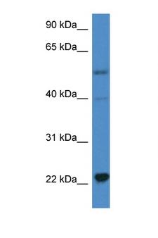 IL18 Antibody - IL18 / IL-18 antibody Western blot of HeLa Cell lysate. Antibody concentration 1 ug/ml.  This image was taken for the unconjugated form of this product. Other forms have not been tested.