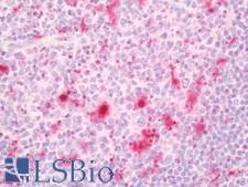 IL18 Antibody - Human Tonsil: Formalin-Fixed, Paraffin-Embedded (FFPE).  This image was taken for the unconjugated form of this product. Other forms have not been tested.